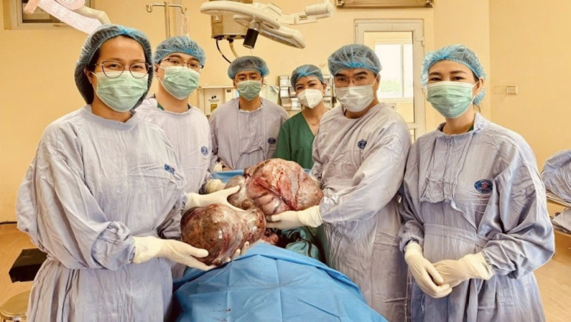 Cô gái H’Mông 16 tuổi được cứu khỏi khối u buồng trứng gần 15kg
