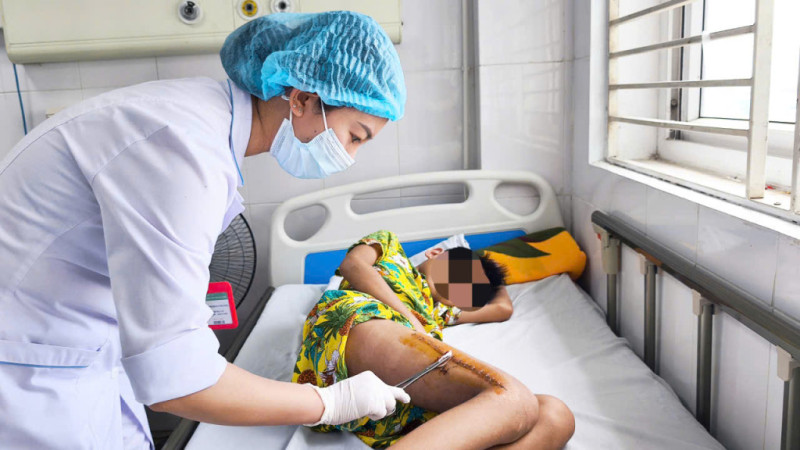 Bé trai 11 tuổi suýt mất mạng, mất chân vì tụ cầu vàng “ăn mòn” xương đùi