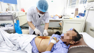 Cụ ông 71 tuổi viêm tụy cấp, nhiễm trùng đường mật bởi sỏi mật tái phát