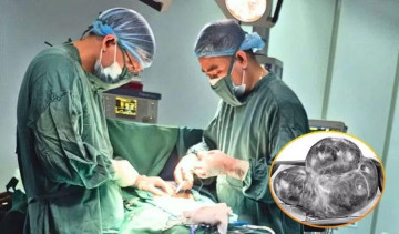 Phẫu thuật thành công khối u buồng trứng nặng 5kg cho nữ bệnh nhân 59 tuổi