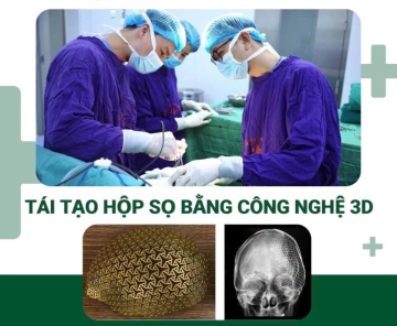 Tái tạo hộp sọ bằng công nghệ 3D: Bước tiến trong phẫu thuật thần kinh