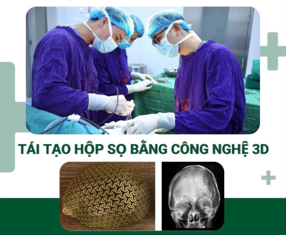 Tái tạo hộp sọ bằng công nghệ 3D: Bước tiến trong phẫu thuật thần kinh