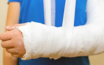 Dấu hiệu gãy xương không nên chủ quan