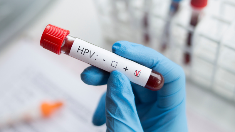 Xét nghiệm HPV dương tính có phải mắc ung thư cổ tử cung?