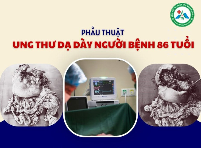Quảng Ngãi: Phẫu thuật thành công cho cụ bà 86 tuổi mắc ung thư dạ dày giai đoạn tiến triển