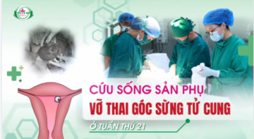 Nghệ An: Cứu sống sản phụ vỡ thai góc sừng tử cung ở tuần thứ 21
