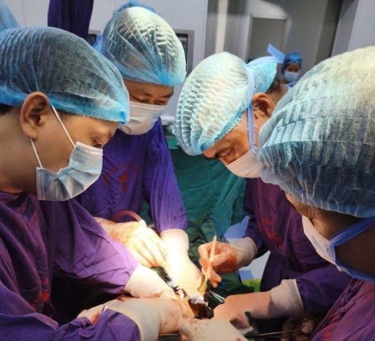 Hà Nội: Phẫu thuật cứu sống bệnh nhân tự ý dùng thuốc Nam khiến khối u gan tái phát nặng 3,5 kg